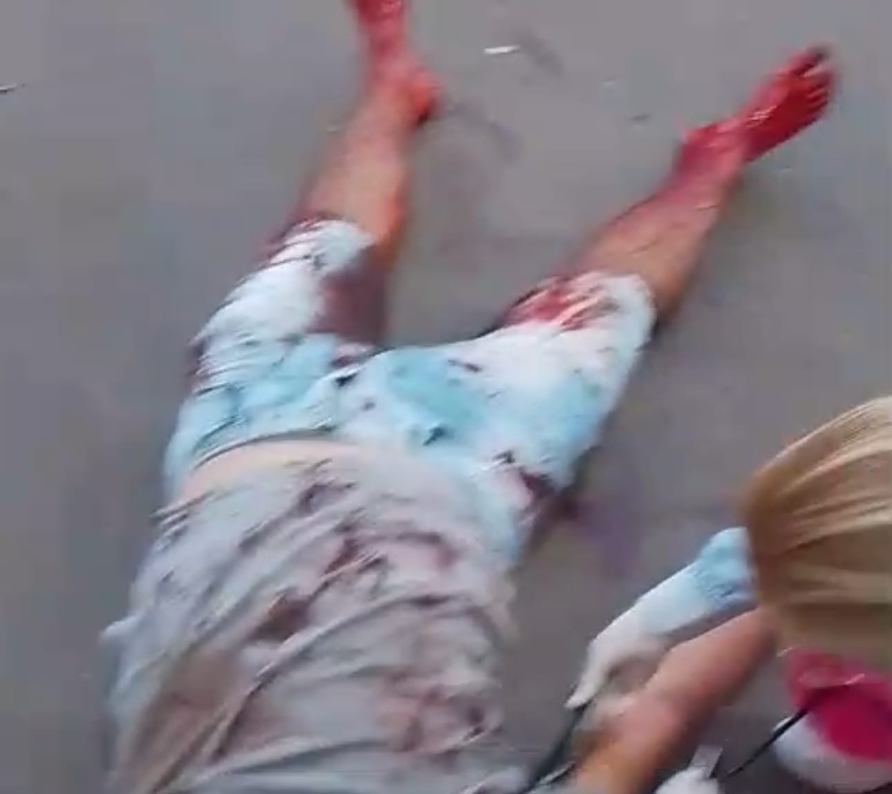 Homem é esfaqueado nove vezes pelo ex-namorado da companheira em Cuiabá