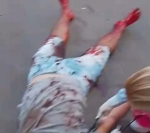 Homem é esfaqueado nove vezes pelo ex-namorado da companheira em Cuiabá