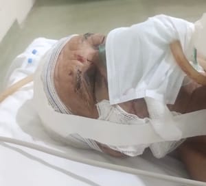 Homem que tentou matar idoso em Várzea Grande se entrega em Cuiabá, confessa crime brutal e é liberado horas depois