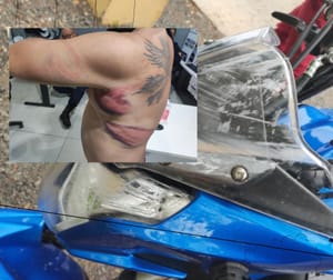 TENTATIVA DE LATROCÍNIO: MOTOCONDUTOR É ATACADO COM FACÃO E CABO DE ENXADA APÓS CORRIDA FORA DO APLICATIVO