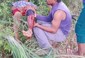 URGENTE: Motociclistas batem de frente na estrada da Furnas, no Manso, e ficam em estado grave